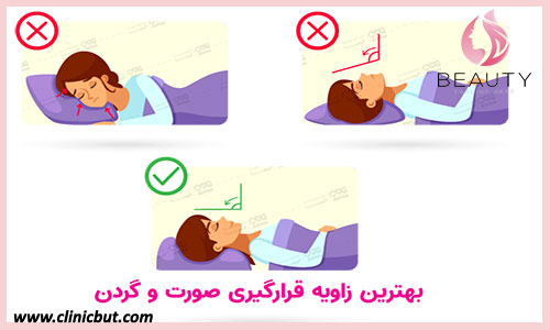نحوه و طرز خوابیدن بعد از تزریق بوتاکس
